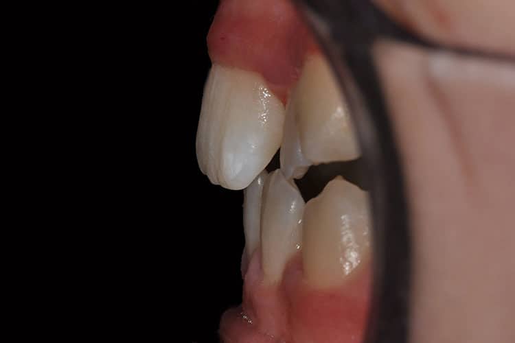 Ortodonzia-1-4